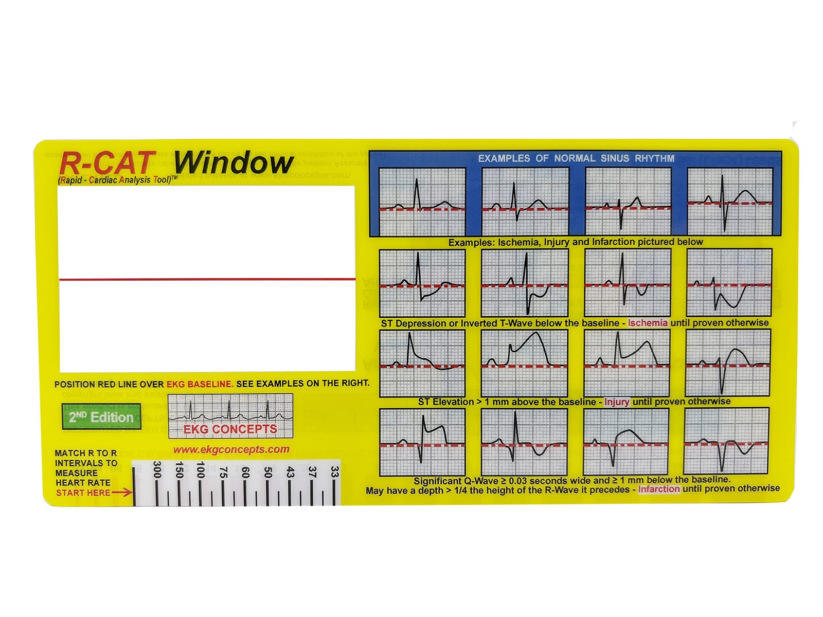 EKG Window 2nd Edition