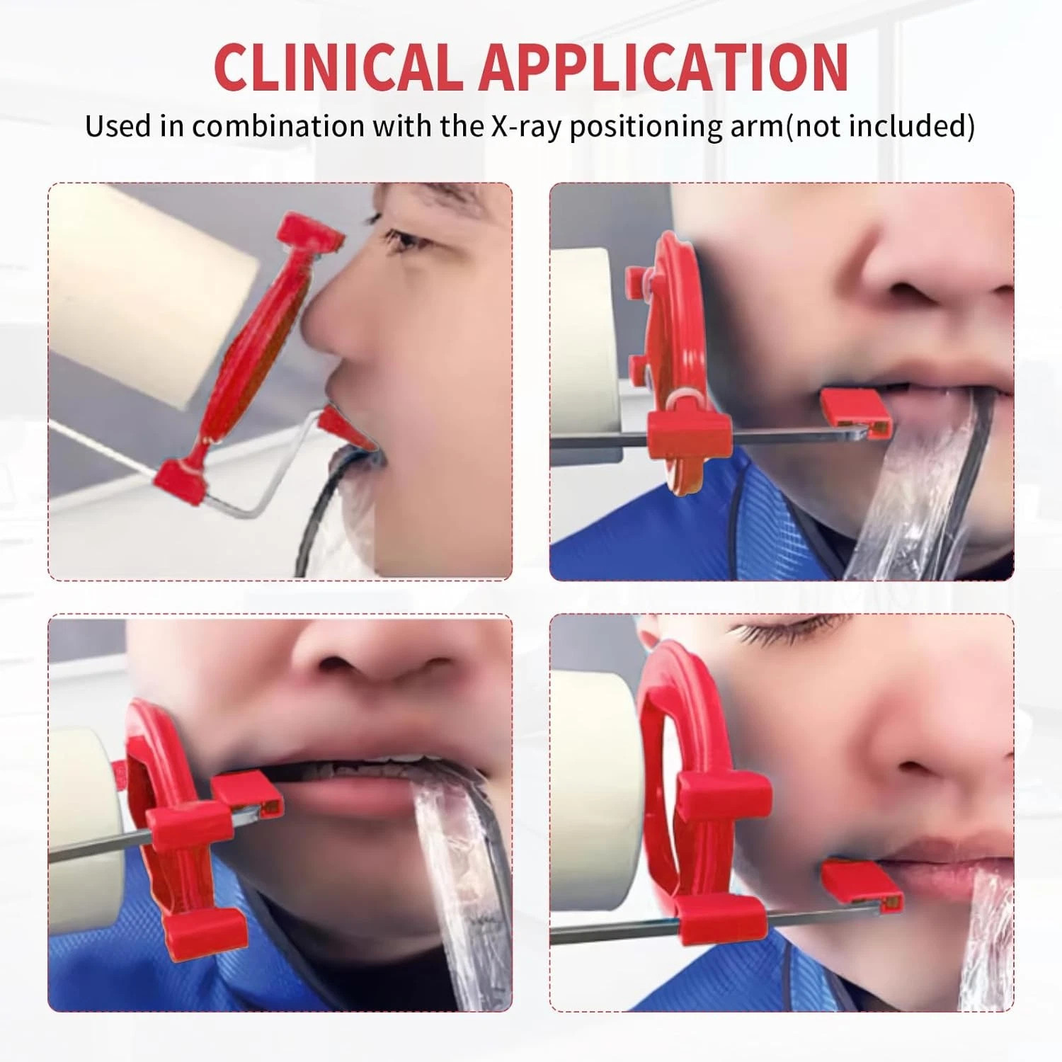 5Pcs Dental Aiming Ring X-RAY Positioning System Type Bite Wing