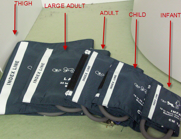 SINGLE HOSE TUBE, BLADDER  NIBP CUFF LARGE ADULT SIZE (33-47CM)  PATIENT MONITOR