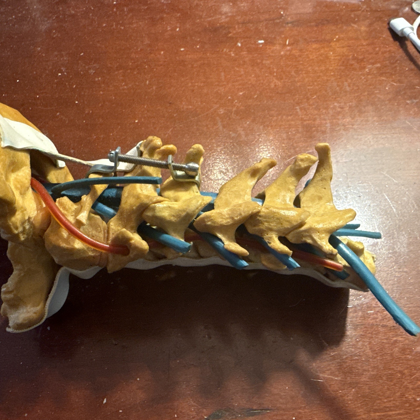 Cervical Spine Model With Fixation