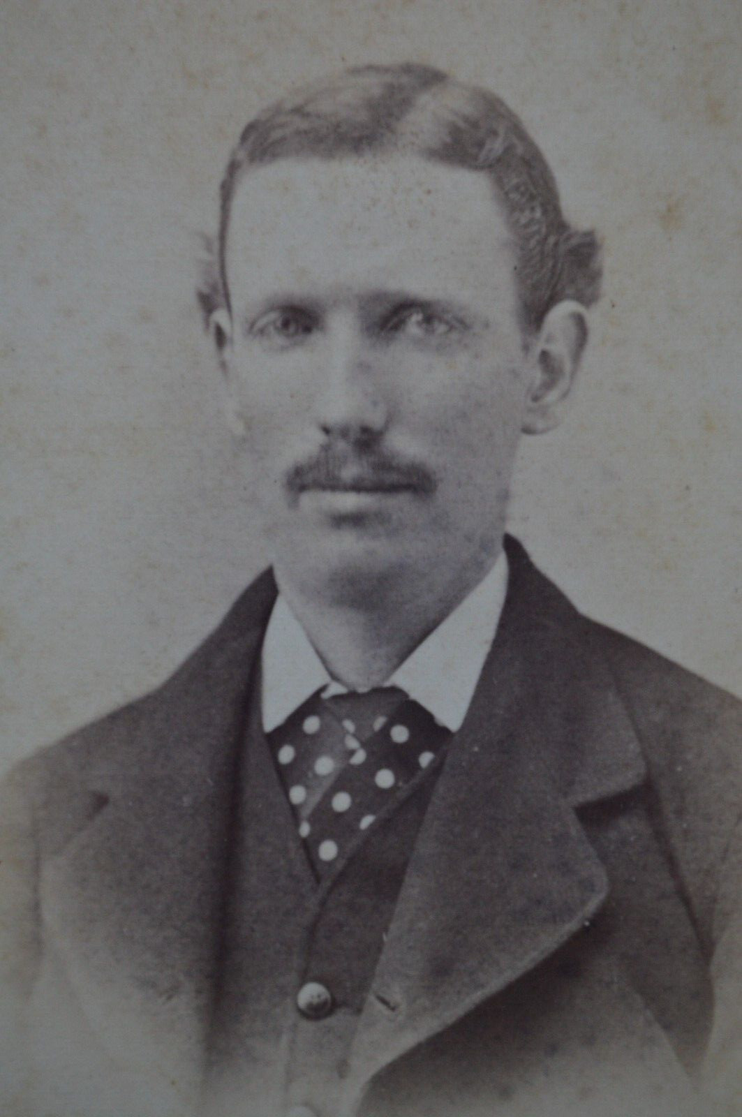 1800s Photo Identified Man Medical Suffered Epileptic Fits Trenton NJ Studio CDV
