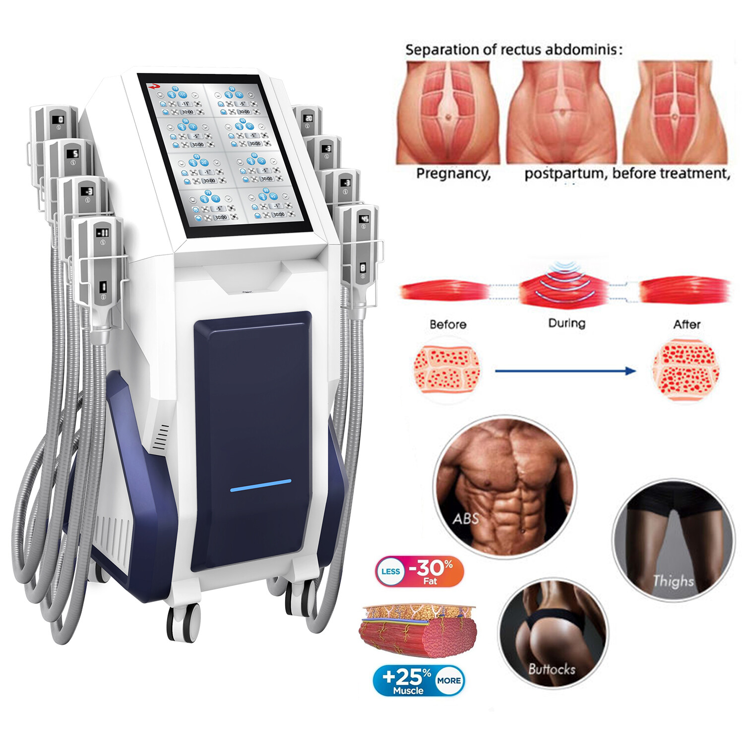 Body Shape Cryo Cool Fat Freezing Body Sculpting Slimming Machine Fat Removal