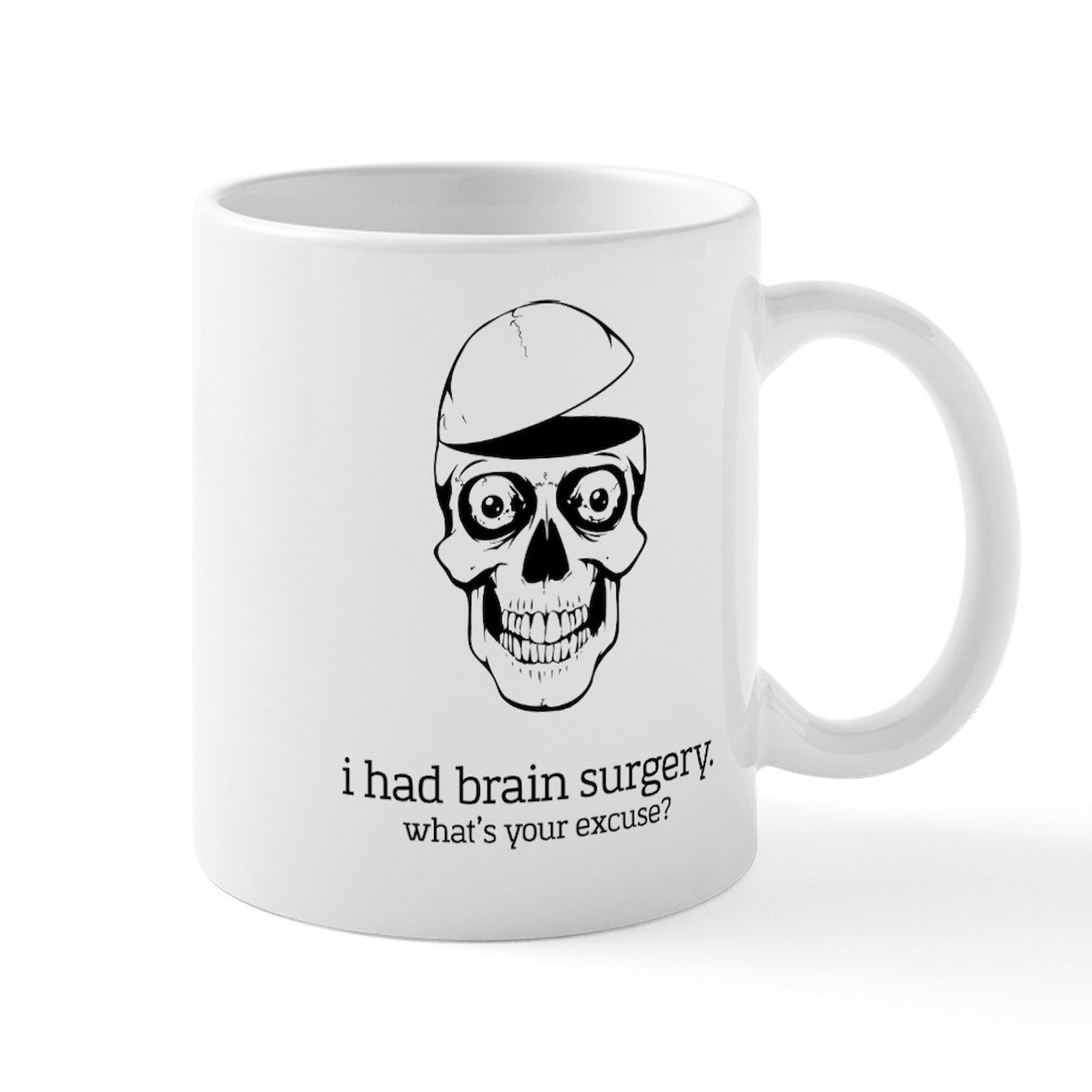 CafePress I Had Brain Surgery Mugs 11 oz Ceramic Mug (1309888567)