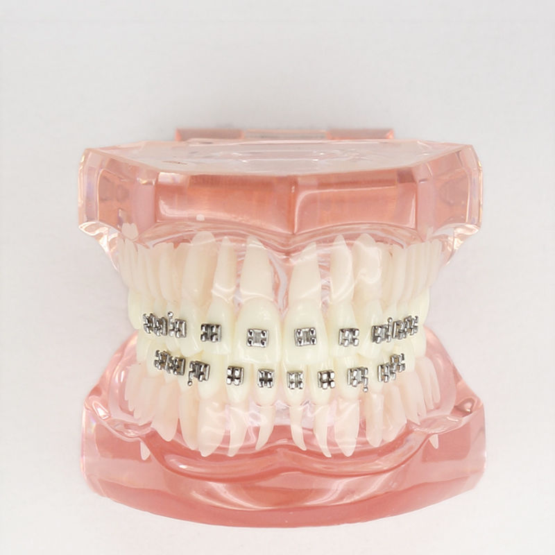 Dental OrthodonticDemo Model for Patient Student w/ 20 Pcs Metal Bracket Brace