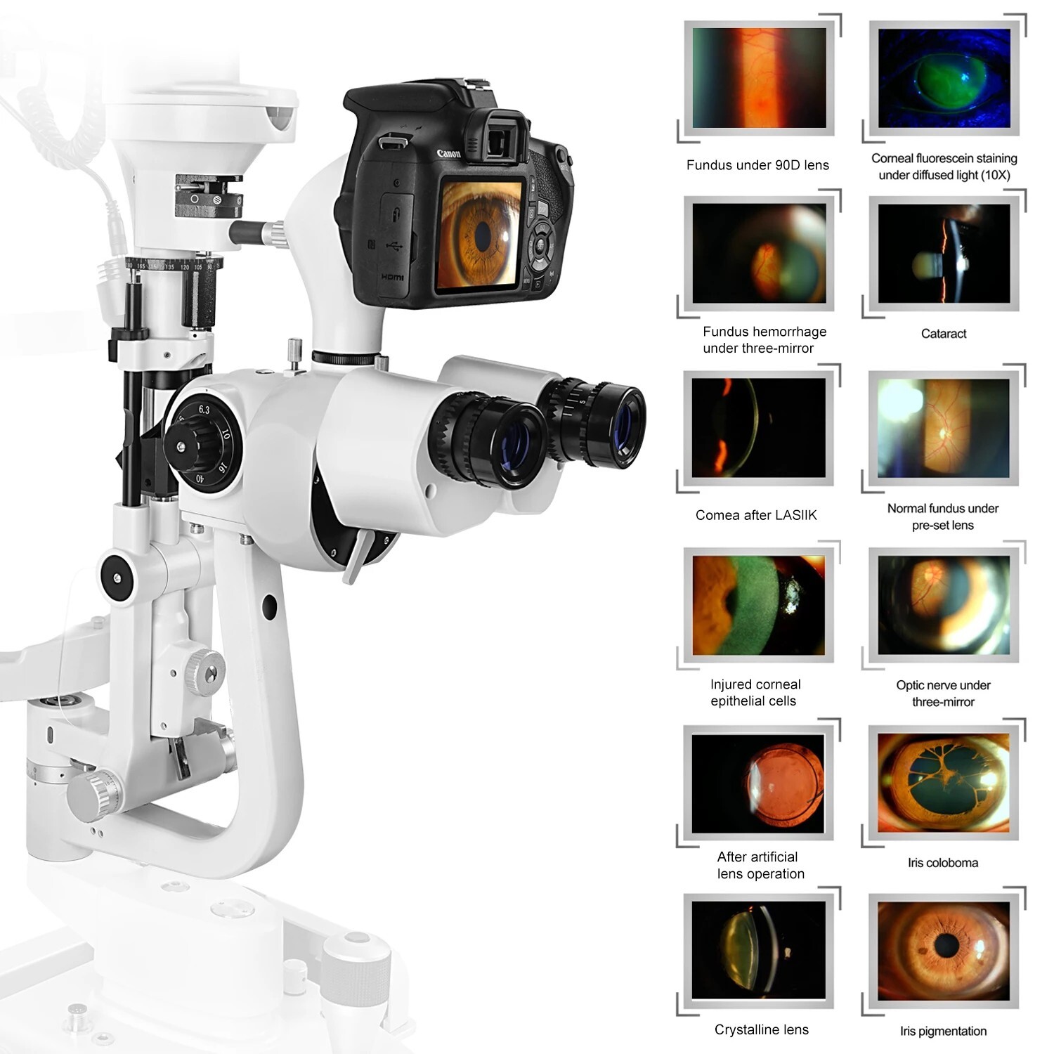 Professional Digital Slit Lamp 5-Speed LED Magnifier Ophthalmic Equipment