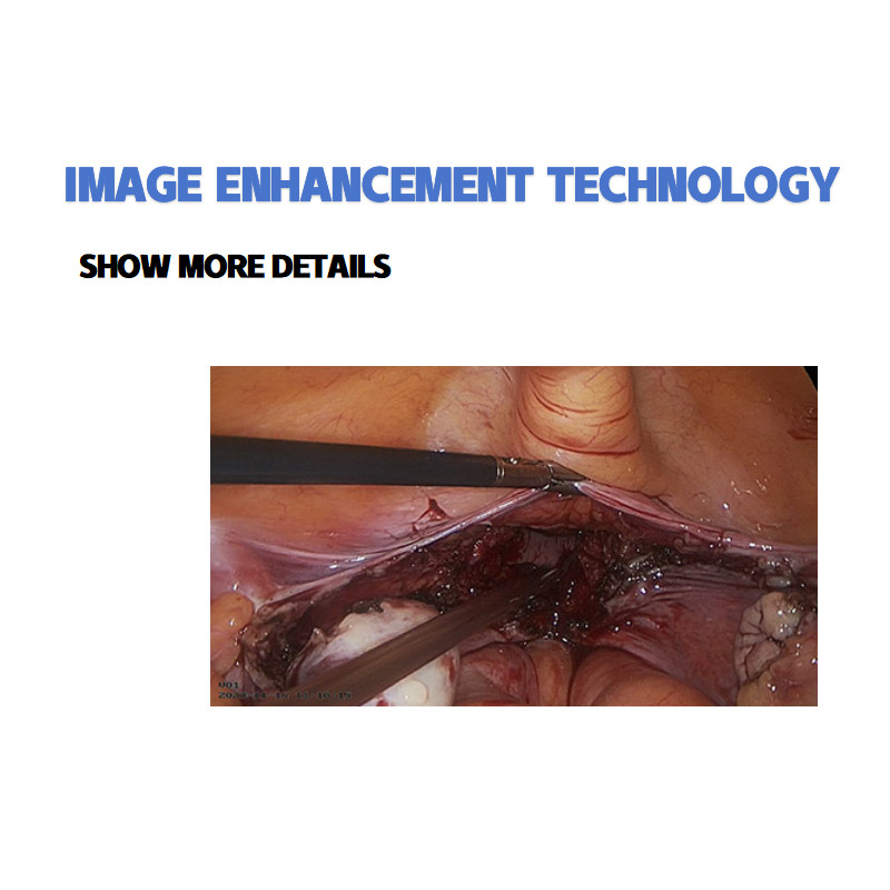 4k Endoscopy Laparoscopic Camera System Ultra HD Endoscope Camera Multiple surg