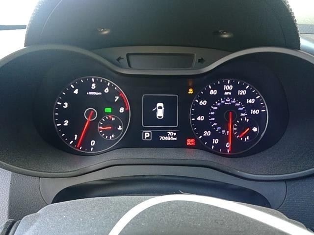 Alternator With Automatic Engine Stop And Start Fits 12-17 RIO 2488551