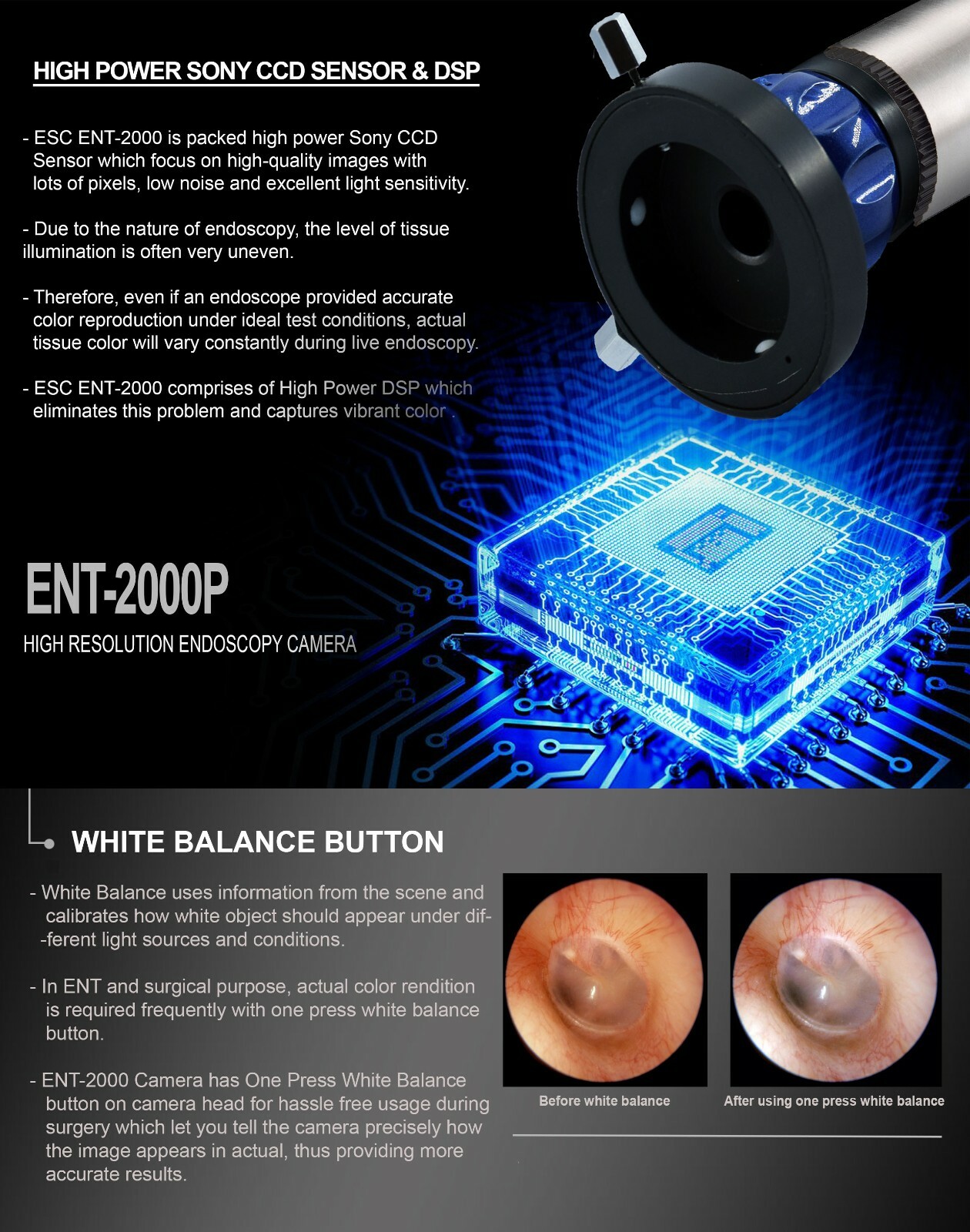 USB Endoscopy Camera HD w/ Portable Cold LED Light Source for Rigid Endoscopes