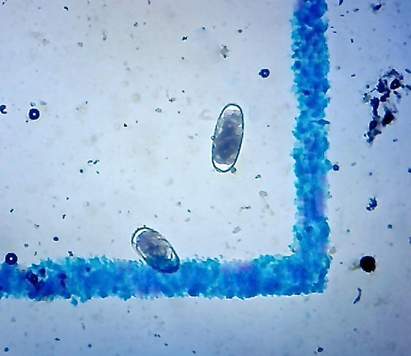 Mcmaster Method Microscope Slide - FEC (Fecal Egg Count) or Worm Count, Doubl...
