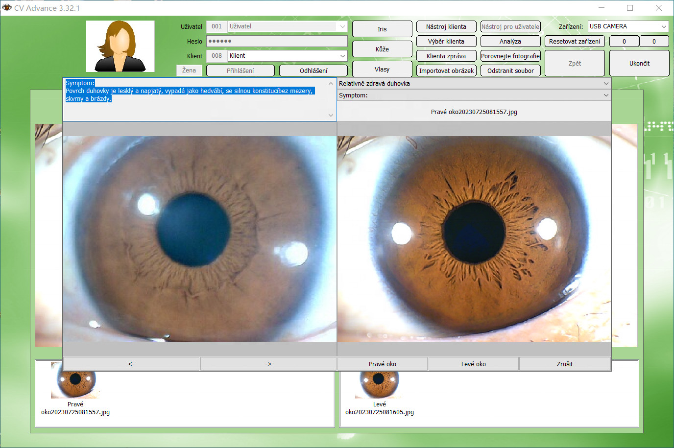 Analyzer Camera HD Iriscope Eye Camera with Analysis Software for Detailed Eye