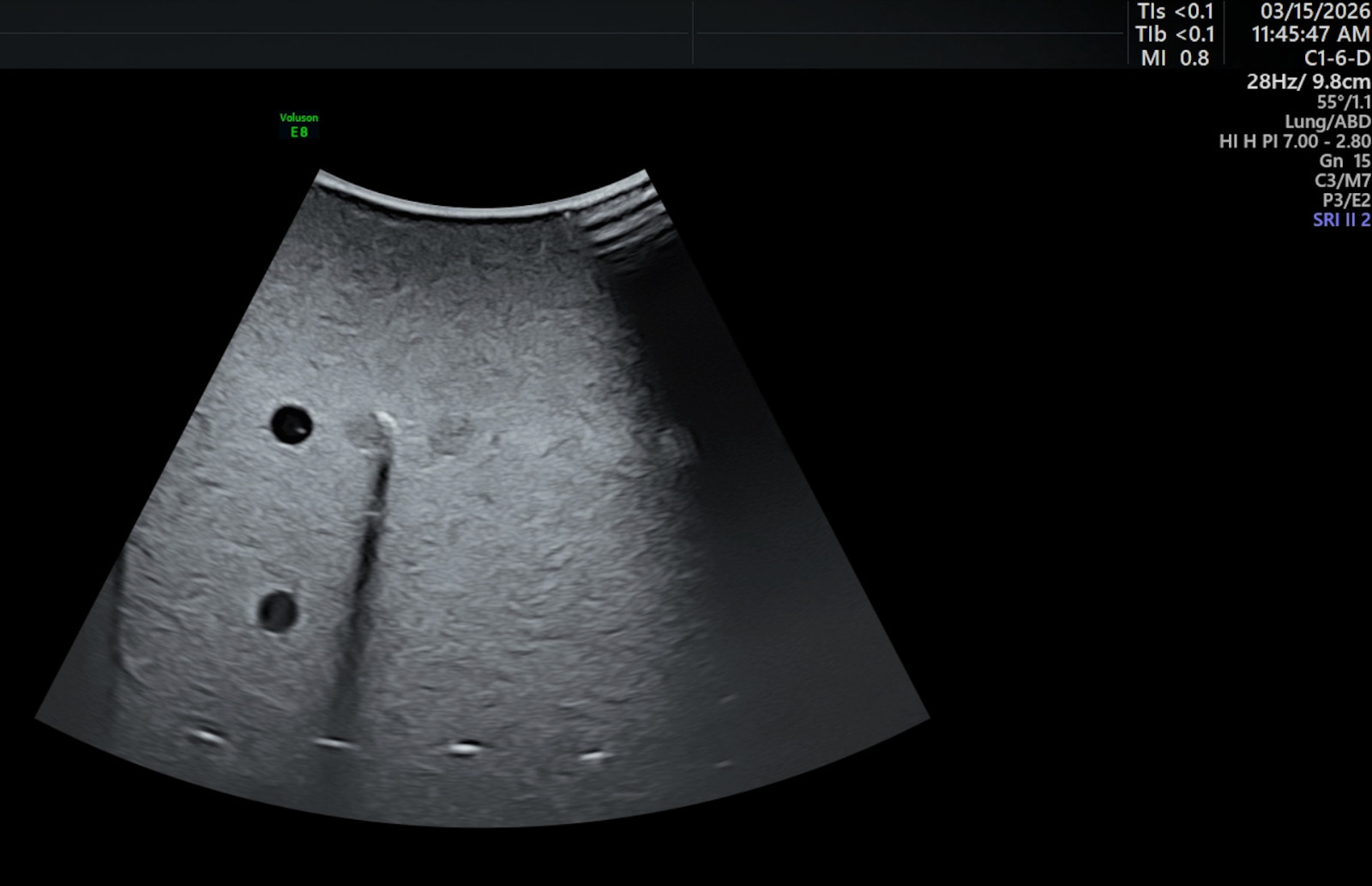 GE C1-6-D XDClear Ultrasound Probe | Tested | 60 Day Warranty | SN 01YP4