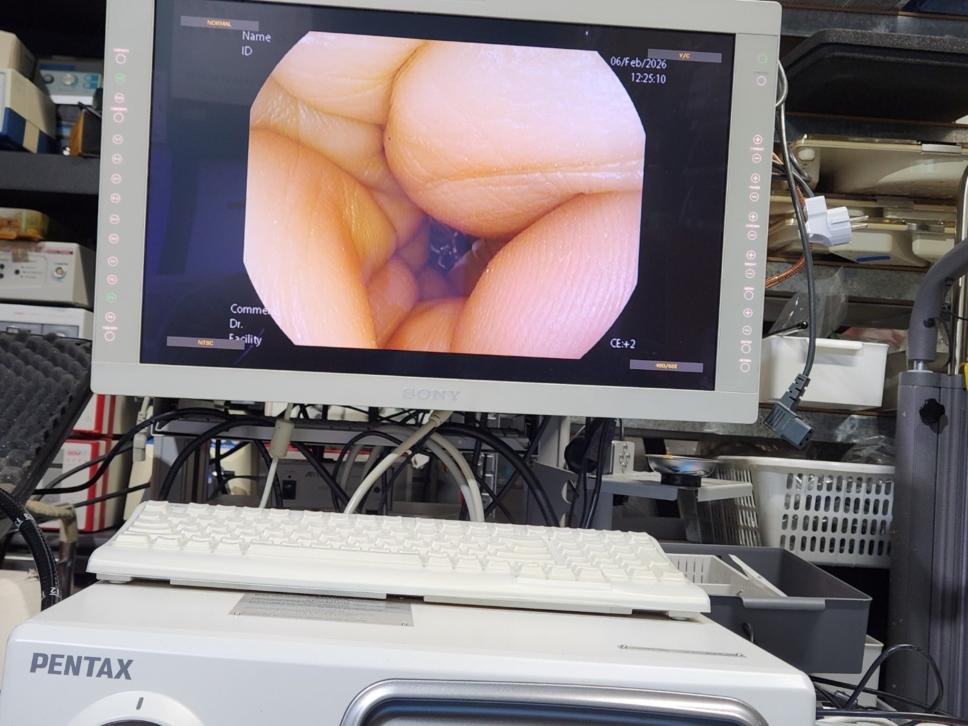 Pentax EPK-i7000 HD Endoscopy System