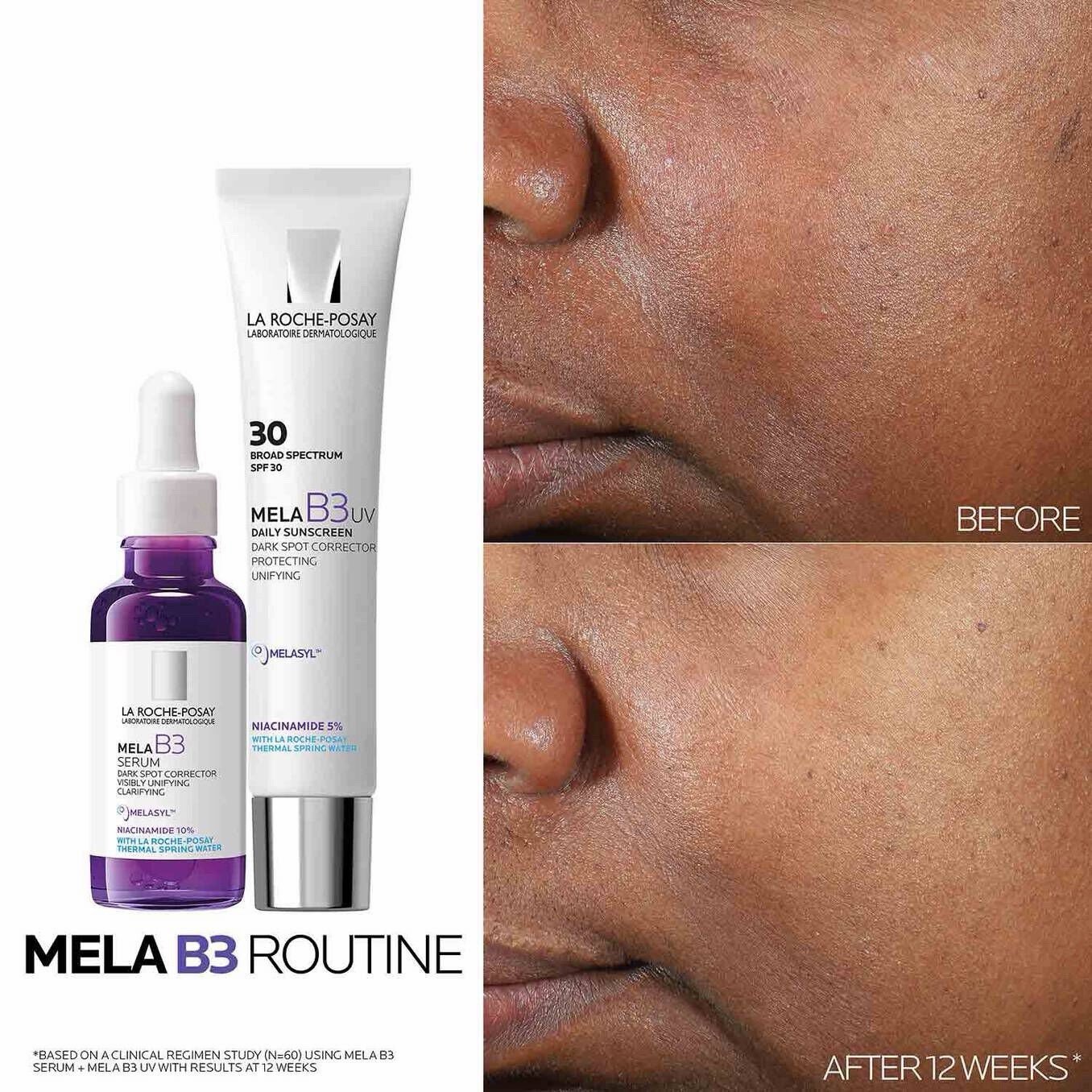 la roche-posay mela b3 dark spot corrector Travel Set