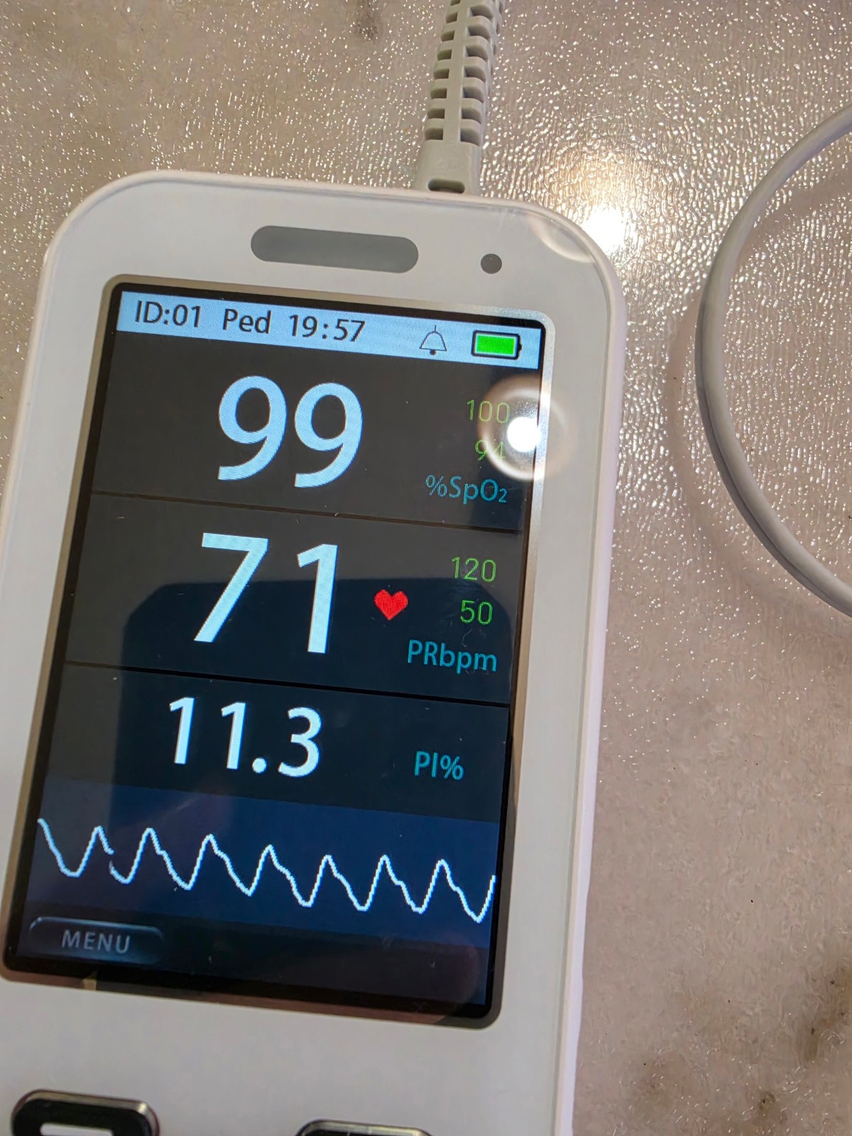 Yimi Life HS10A Handheld Medical Pulse Oximeter