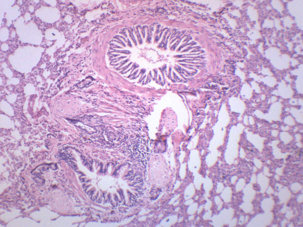 Human Lung Section - Prepared Microscope Slide - 75x25mm - Eisco Labs