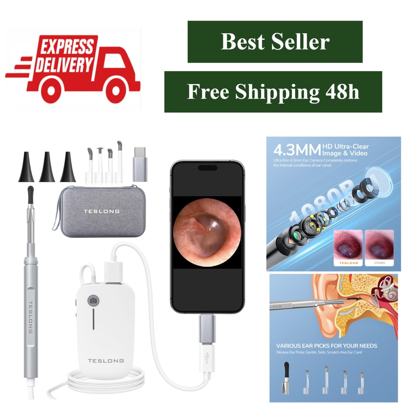 Digital Otoscope 1080P HD Camera with Light for USB-C Devices