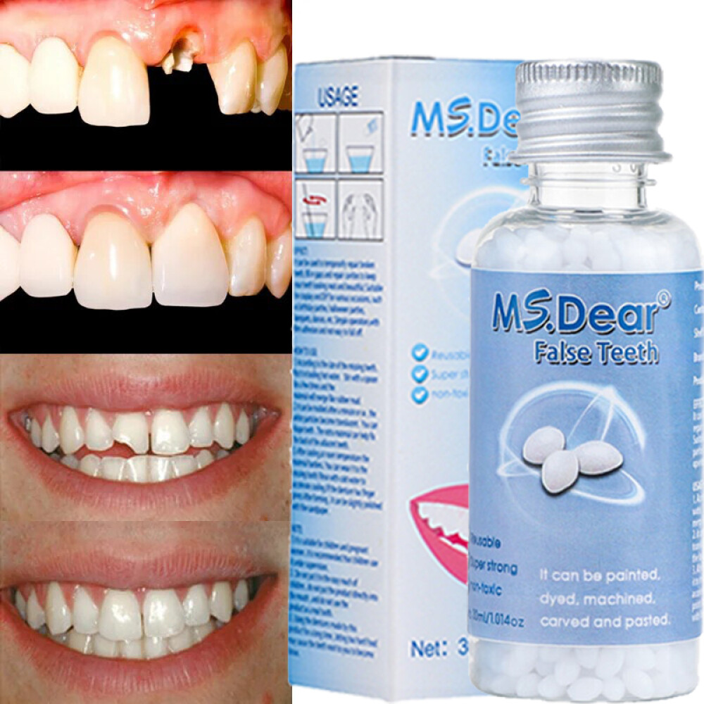 Tooth Repair Granules Temporary Kit Fitting Bead Reusable Moldable False Teeth