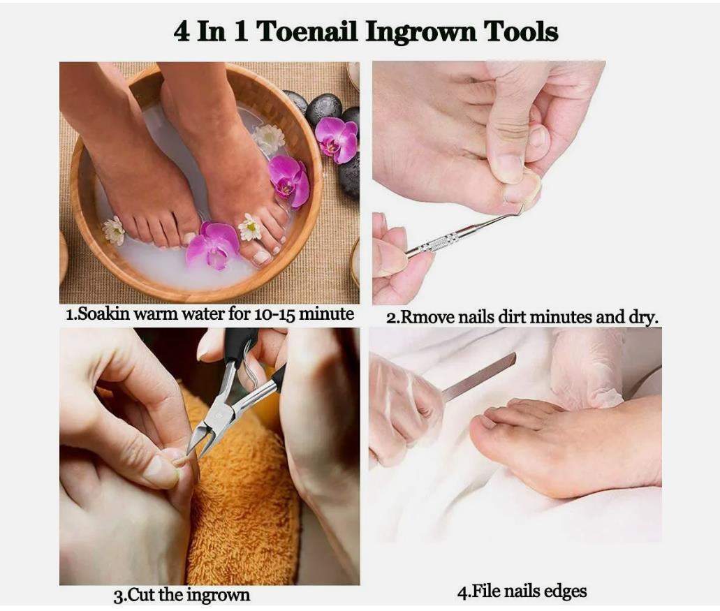 Heavy Duty Nail Scissors for Thick Ingrown Toenails - Precision Clipper Tool