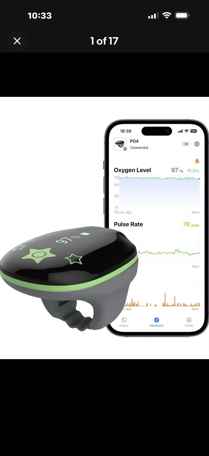 Pulse Oximeter for kids Tracking SpO2 and Pulse Rate with Free APP