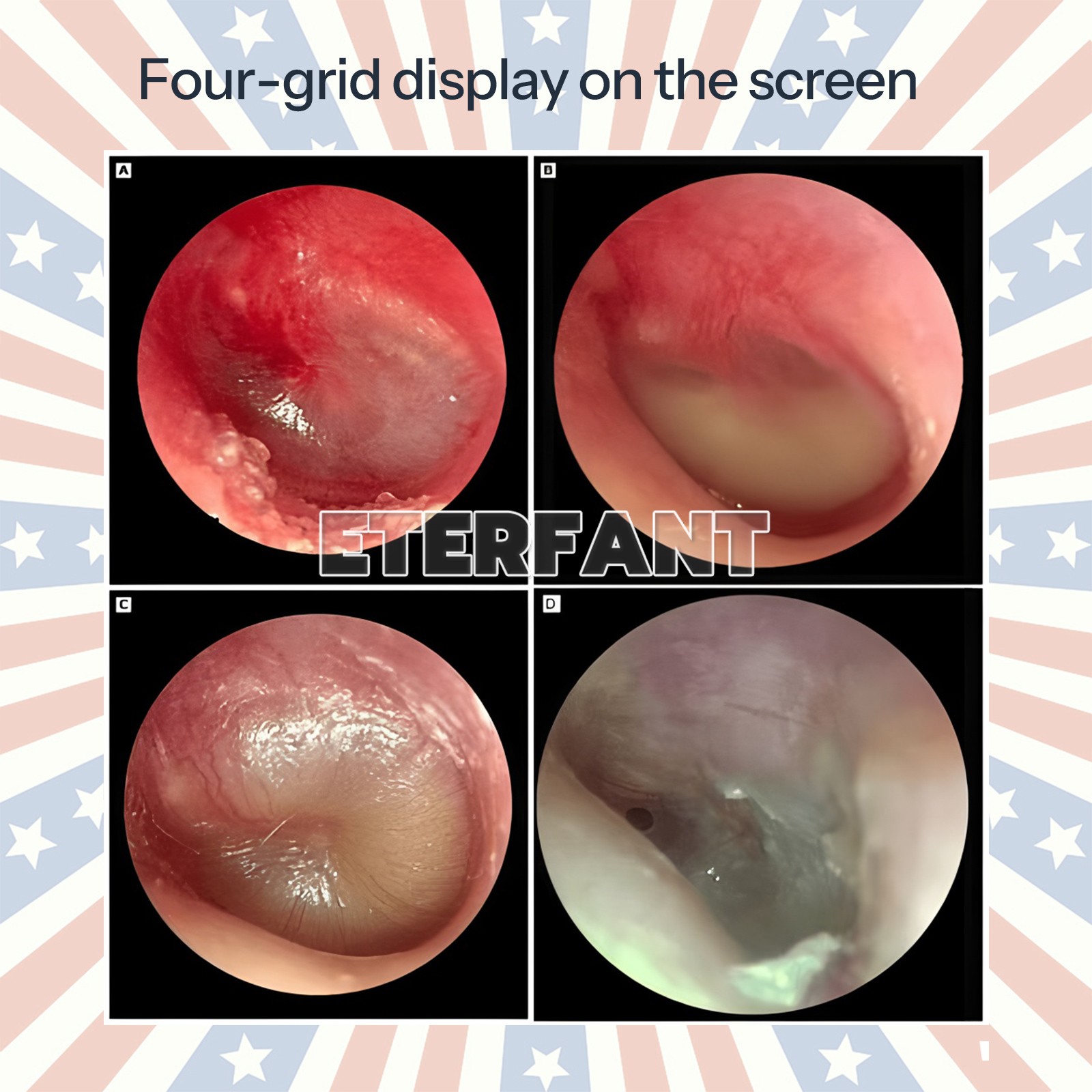 Endoscopy Camera Full Hd 1080p Laparoscopic Endoscope System for Laparoscopy