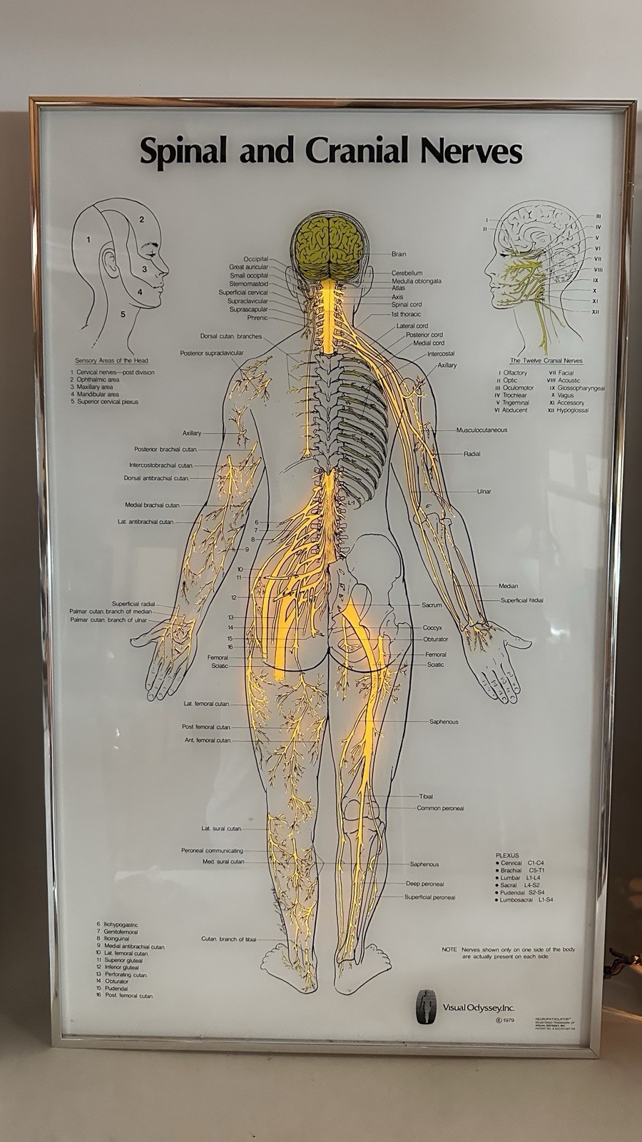 Visual Odyssey Neuropatholator Medial Display - Powers on for Parts Repair READ