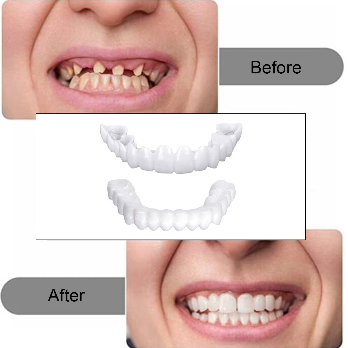 Snap On Veneers Upper & Lower Set - Instant False Teeth Covers No Adhesive bex
