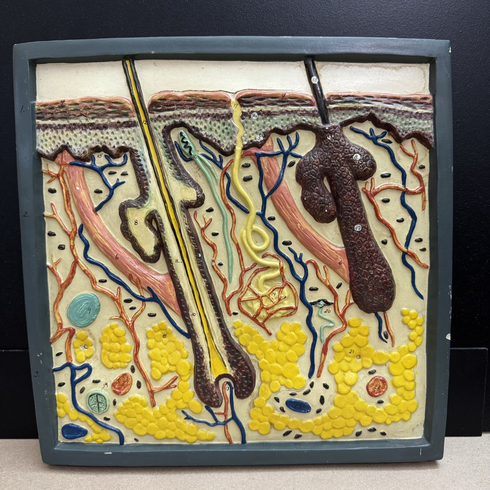 Vintage Turtox Latex Models Anatomical Skin Hair Follicles Dermatology Display