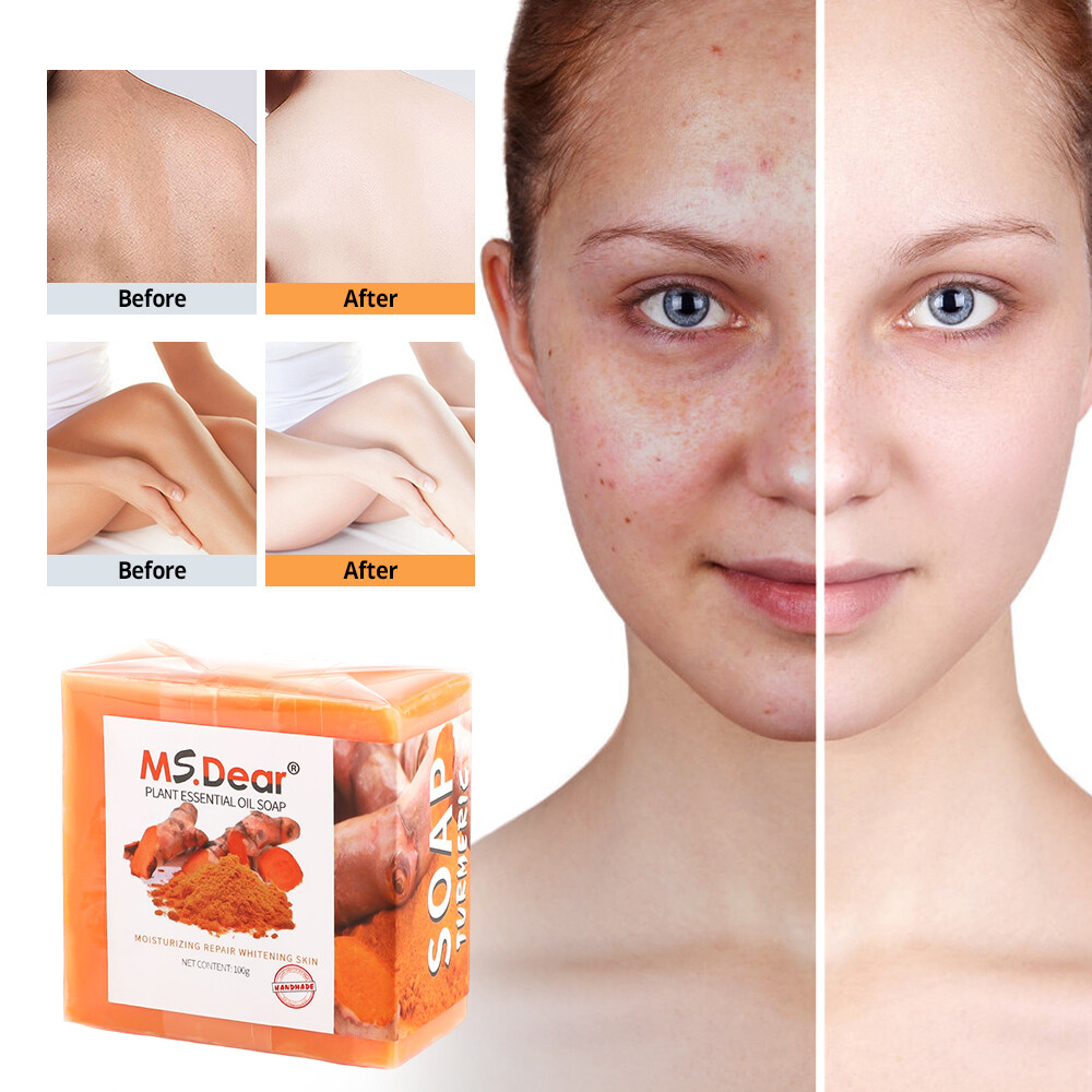 2Pc Turmeric Soap for Face&Body,Skin Brightening Anti-Acne Dark Spots Lightening