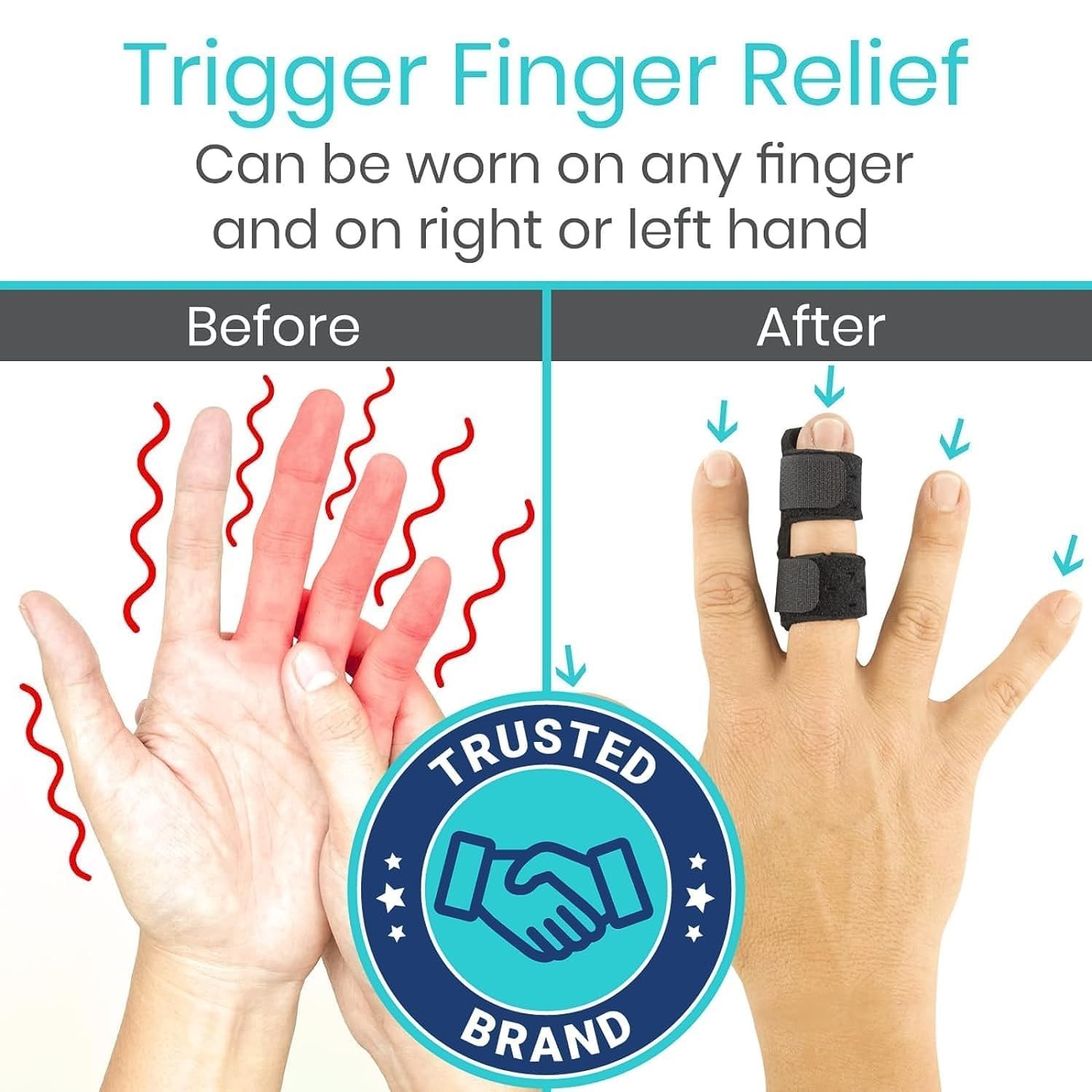 Vive Finger Splint (2 Pack) - Universal Finger Straightener - Broken and Trigger