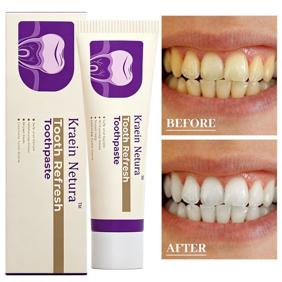 Gum Disease Treatment Toothpaste Gingivitis Receding Gum Teeth Stains Bad Breath