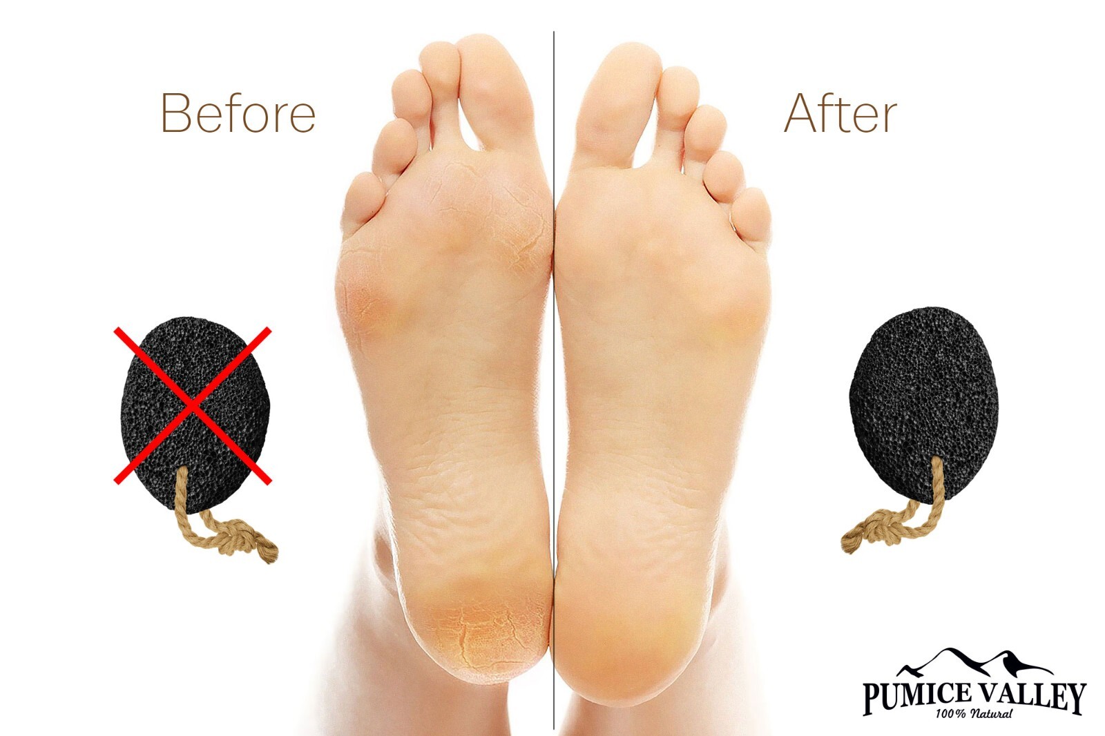Pumice Stone for Feet - Food File - Callus - Corn Remover - Skin Scrubber