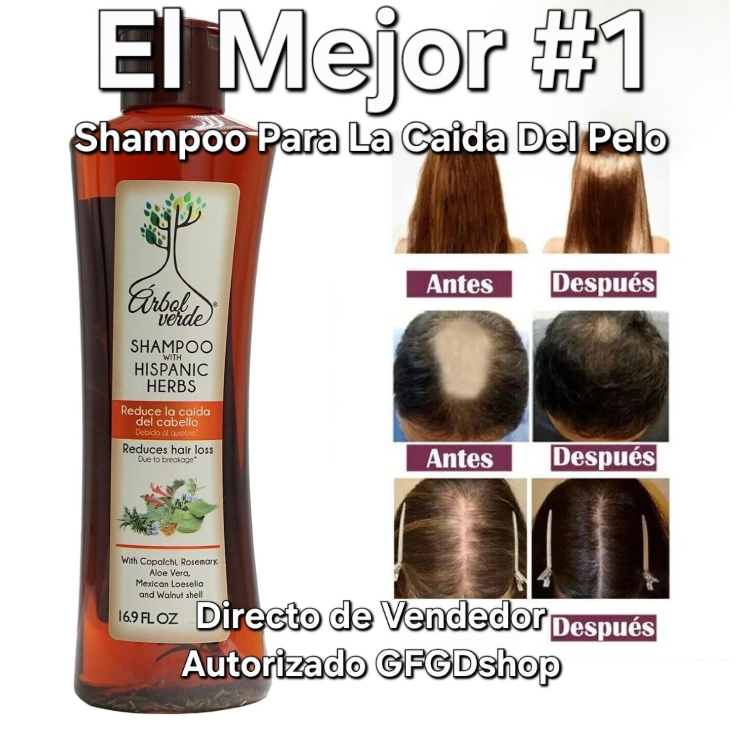 Shampoo Reduce La Caida Del Cabello Tratamiento Champu Para Acelerar Crecimiento
