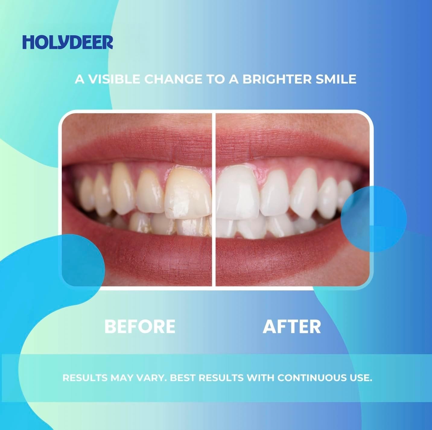 Nano-Hydroxyapatite Toothpaste, Mint, 7.5% Nhap, Fluoride-Free, Sensitive Whiten