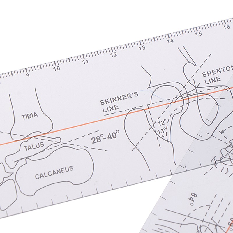 Multi-Ruler Goniometer Angle Medical Ruler Joint Orthopedics Tool Instruments!