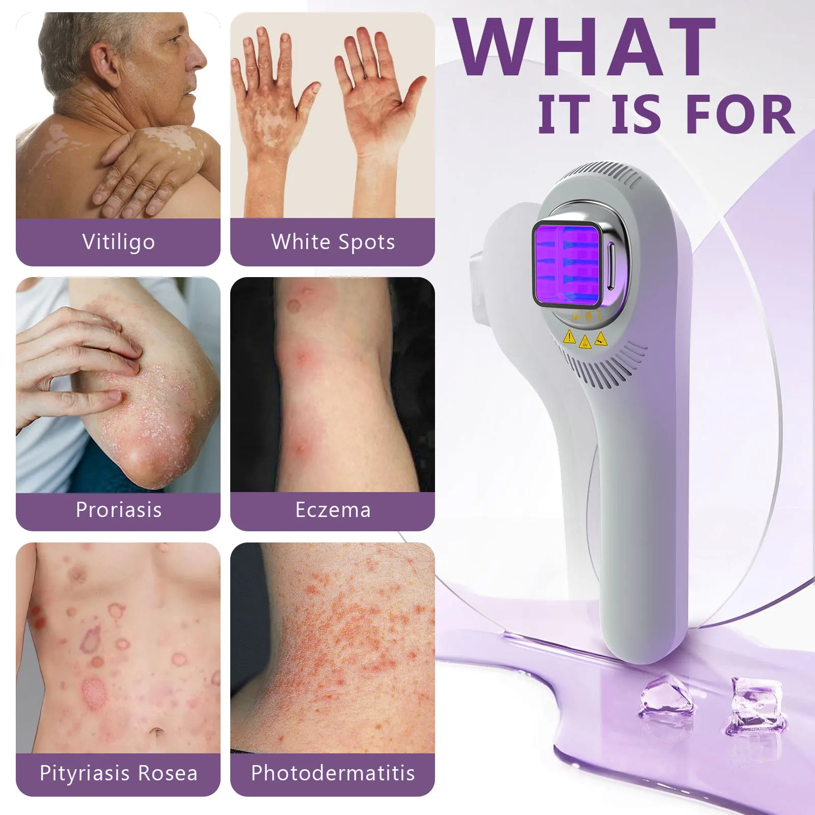 308nm Home Phototherapy UVB Light Lamp Device for Skin Diseases Treatment KTS