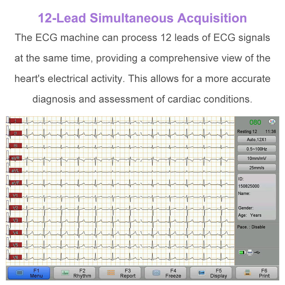 12 channel ECG Machine with interpretation for advisory diagnosis FDA approved