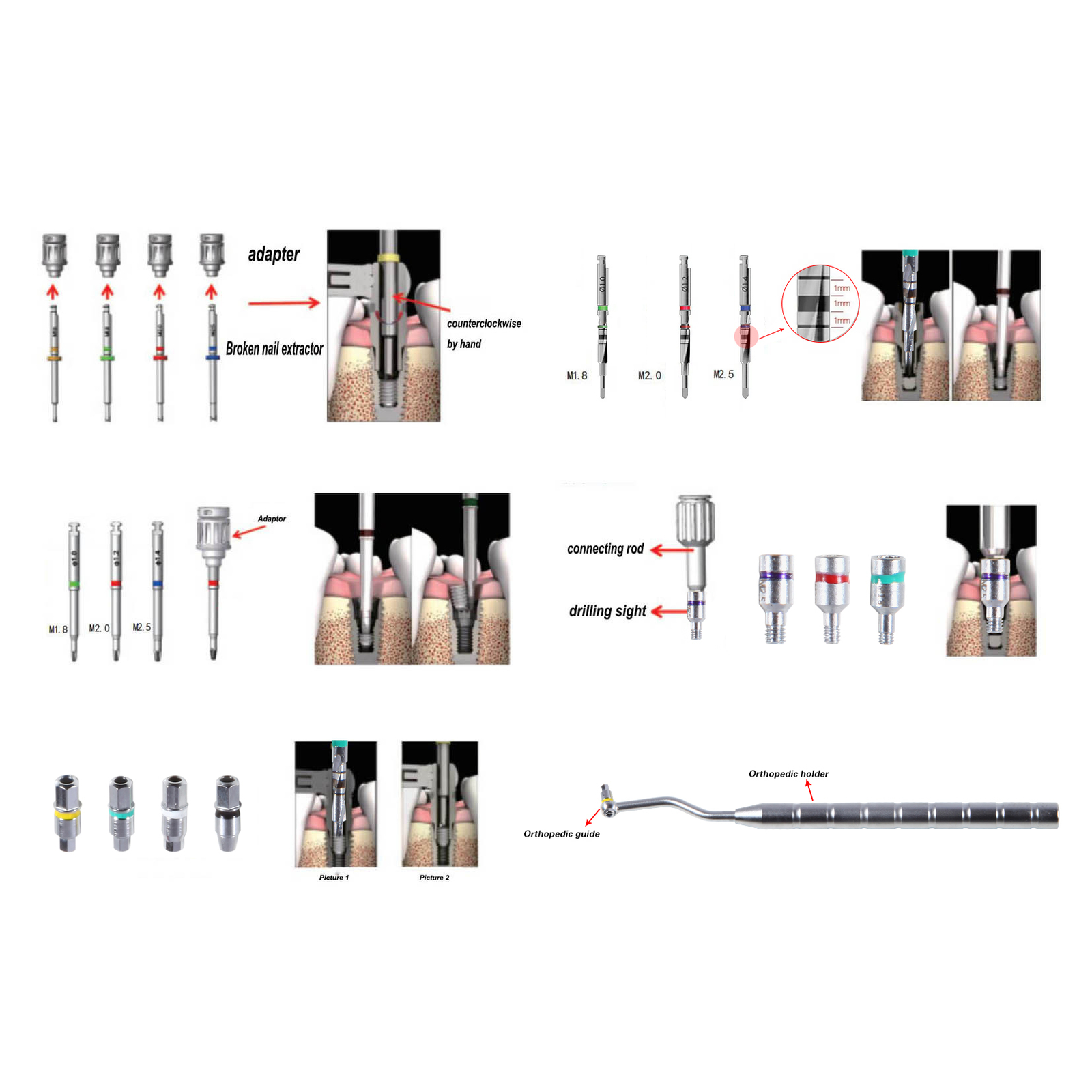 Dental Implant Broken Screw Remover Reverse Drill Guide Driver SR Neobiotech