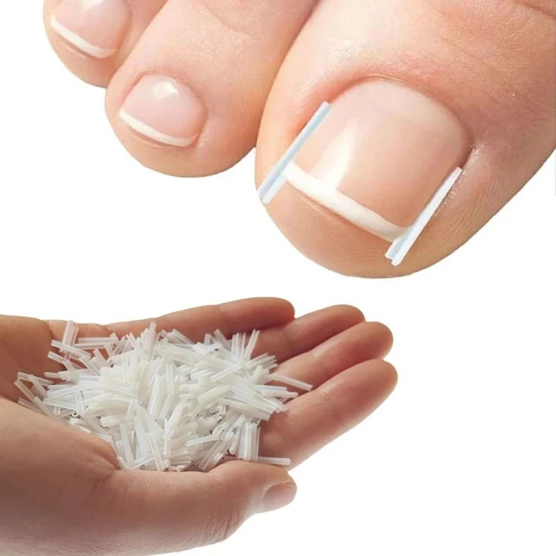 50Pcs Ingrown Toenail Corrector Toe Foot Nail Correction Sticker Pedicure Tool