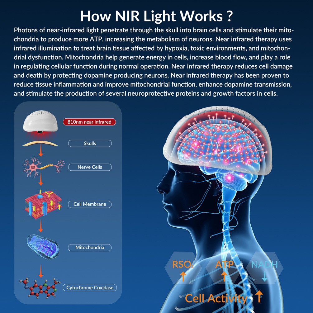 810nm Brain Stimulation NIR Light Helmet for Parkinson Disease Treatmet Migraine