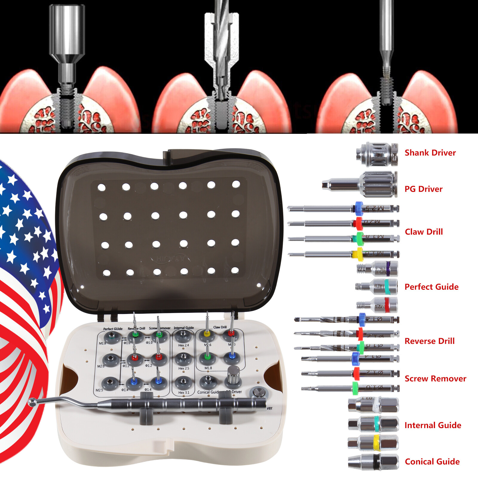 Dental Implant Broken Screw Remover Reverse Drill Guide Driver SR Neobiotech