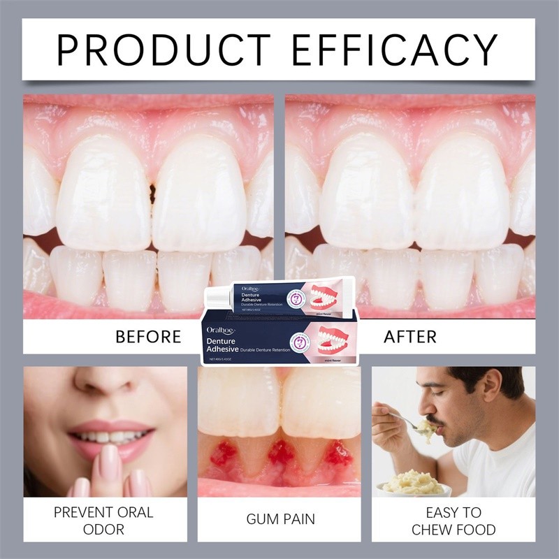 Denttach Denture Adhesive, Thermoplastic Denture Adhesive and Cushion