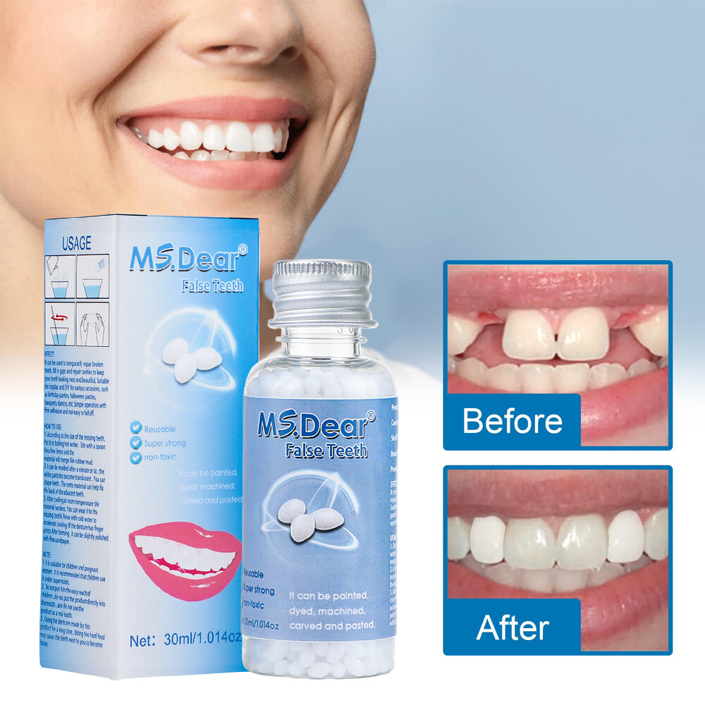 False Teeth Solid Glue Temporary Tooth Gap Filler Tooth Repair Moldable Denture