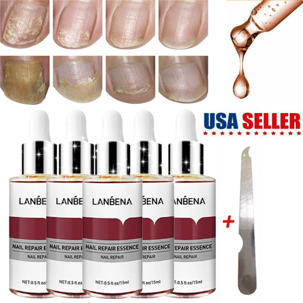 LANBENA Nail Repair Essence Serum Fungus Removal Feet Anti Infection Paronychia