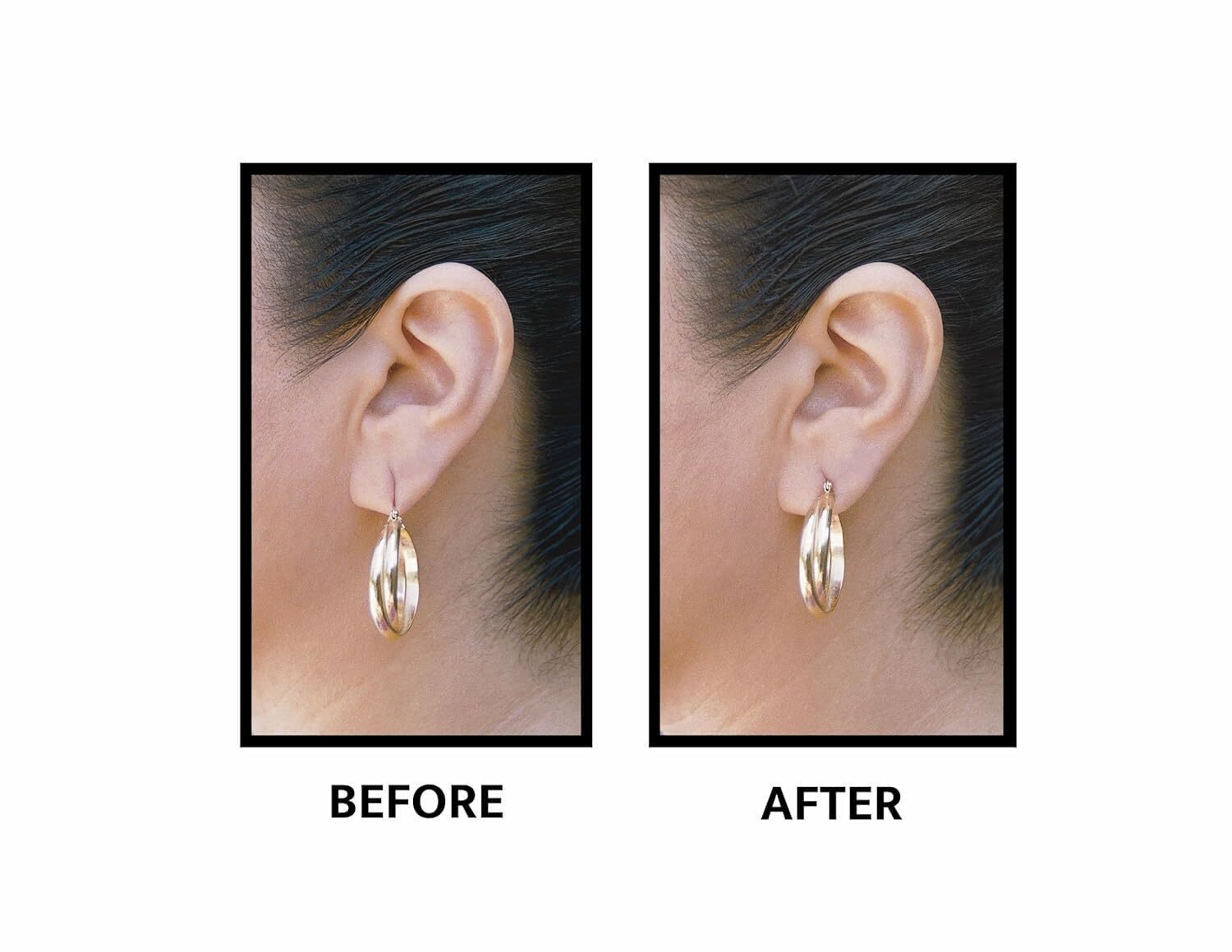 Lobe Wonder Ear Lobe Support Patches -- 60 ct