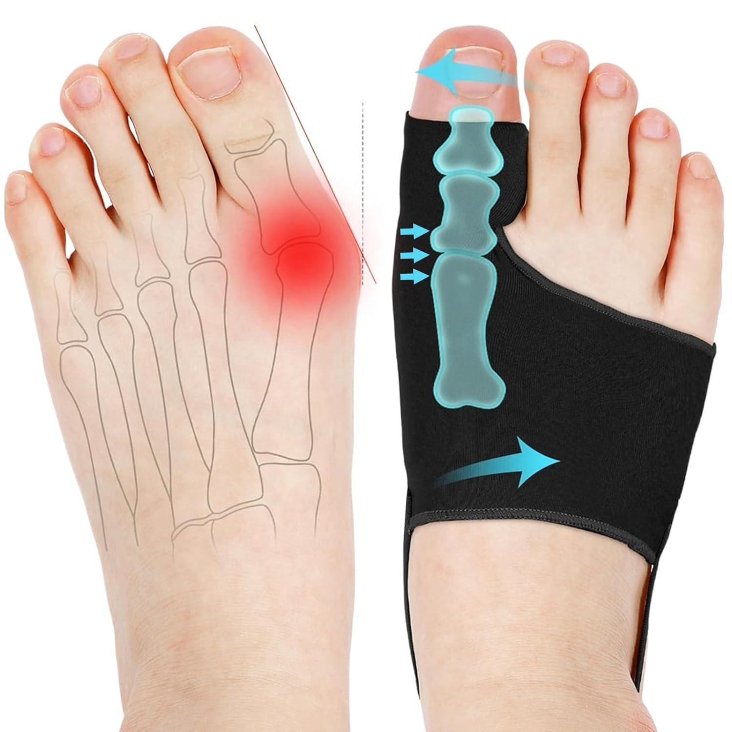 WELEQUT 2-Pack Bunion Corrector for Women & Men, Orthopedic Medium, Black