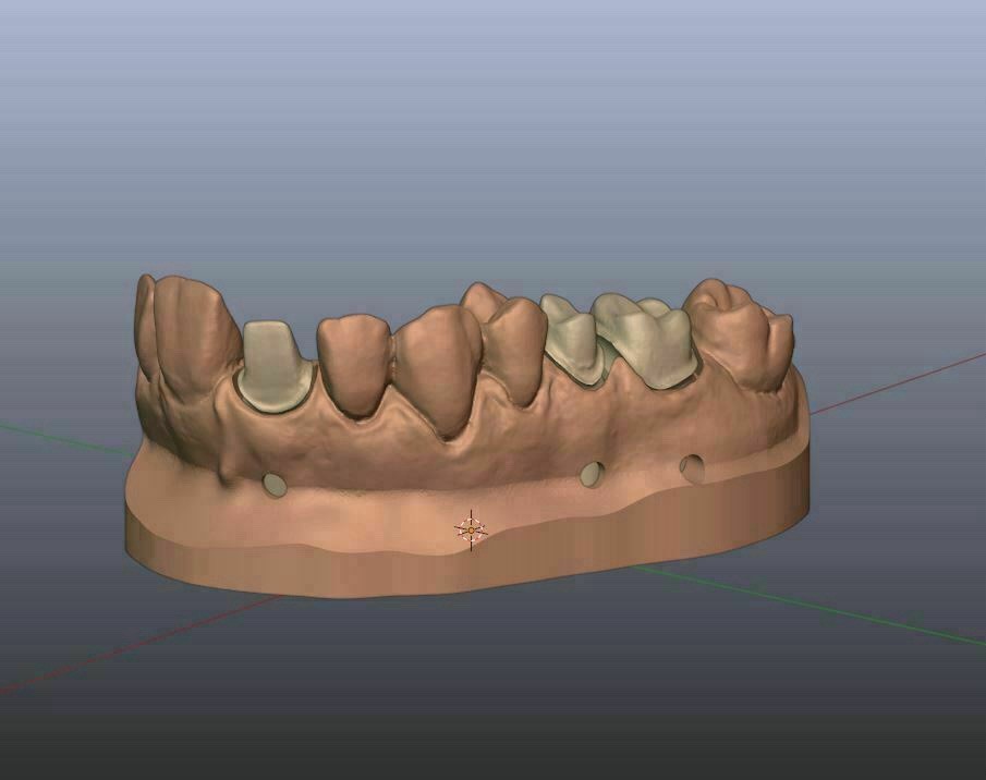 3D DENTAL SCAN SPRAY (12 ea - 1 Box) *Made in Germany (Professional User Only)