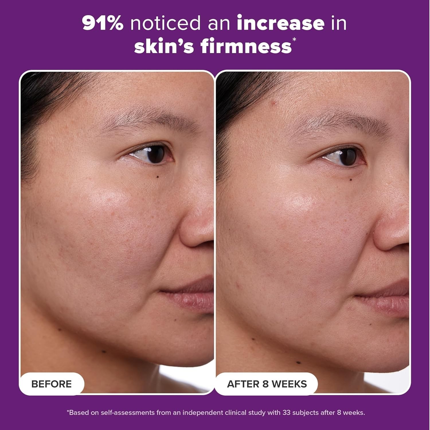 Paula's Choice CLINICAL 1% Retinol Face Treatment with Peptides, Vitamin C & Lic