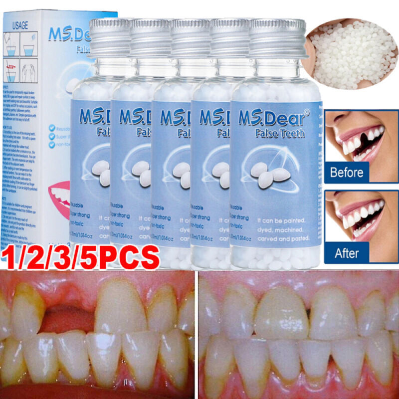 Temporary Tooth Repair Kit Temp Dental Repair Replace Missing Teeth DIY Moldable