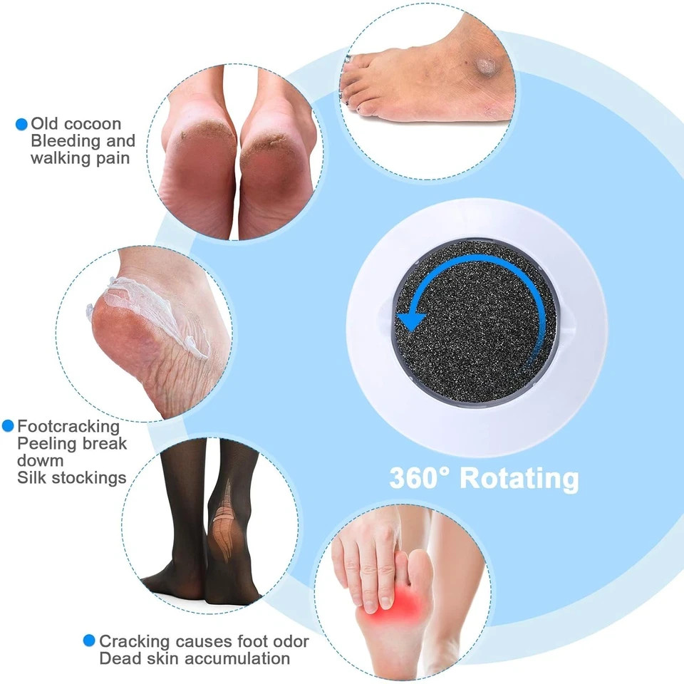 20 Pieces Regular Coarse Replacement Pads for Portable Electric Foot Grinder Foo