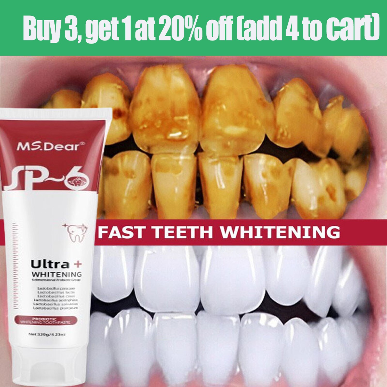 Dual-Action SP-6 Probiotics Whitening Toothpaste-Brightening & Fights Bad Breath
